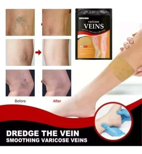 Parche varices x2pack - ZENTORI